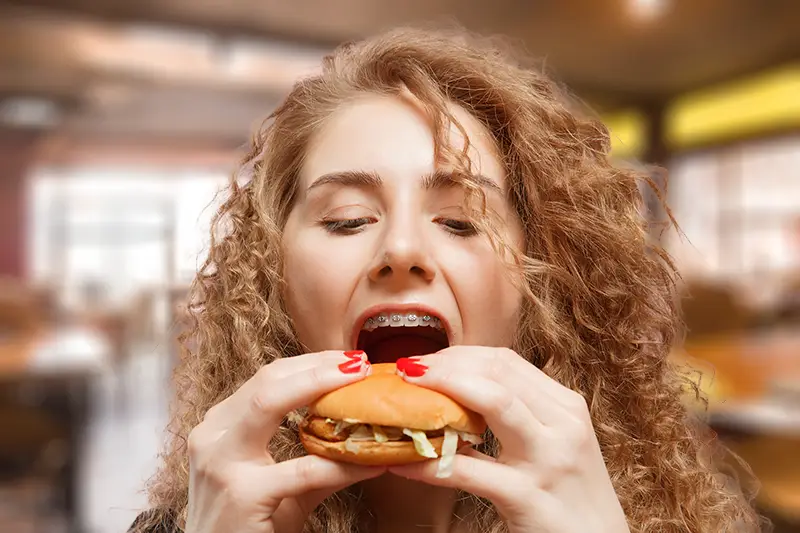 Braces and burgers